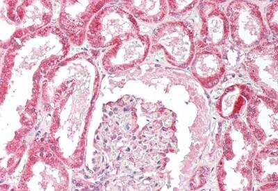 Immunohistochemistry-Paraffin: OSBPL5 Antibody [NB100-57071]