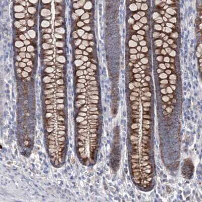 Immunohistochemistry-Paraffin: OSBPL5 Antibody [NBP1-81403]