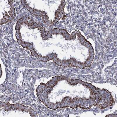 Immunohistochemistry-Paraffin: OSBPL5 Antibody [NBP1-81403]