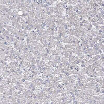 Immunohistochemistry-Paraffin: OSBPL5 Antibody [NBP1-81403]
