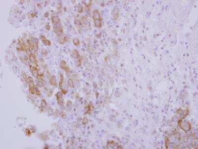 Immunohistochemistry-Paraffin: OSBPL5 Antibody [NBP2-19638]
