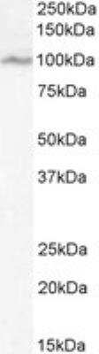 Western Blot: OSBPL5 Antibody [NB100-57071]