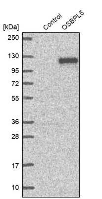 Western Blot: OSBPL5 Antibody [NBP2-38858]