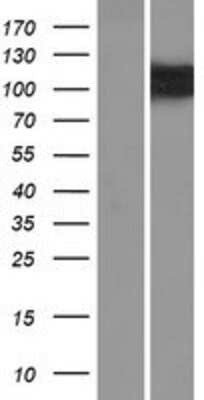 Western Blot: OSBPL5 Overexpression Lysate [NBP2-09706]