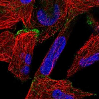 Immunocytochemistry/ Immunofluorescence: OSBPL6 Antibody [NBP1-82475]