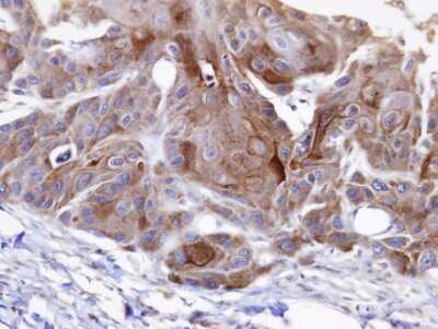Immunohistochemistry-Paraffin: OSBPL6 Antibody [NBP1-31456]