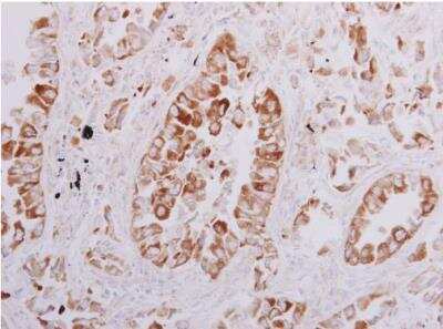 Immunohistochemistry-Paraffin: OSBPL6 Antibody [NBP1-31456]