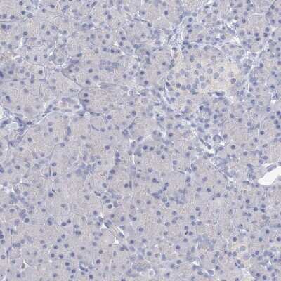 Immunohistochemistry-Paraffin: OSBPL6 Antibody [NBP1-82475]