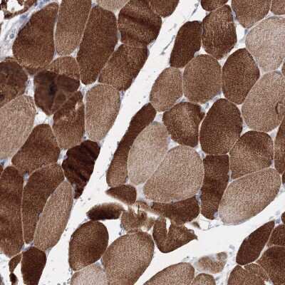 Immunohistochemistry-Paraffin: OSBPL6 Antibody [NBP1-82475]