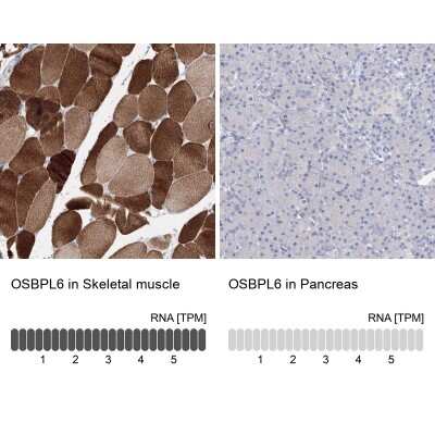 Immunohistochemistry-Paraffin: OSBPL6 Antibody [NBP1-82475]