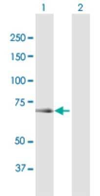 Western Blot: OSBPL6 Antibody [H00114880-B01P]