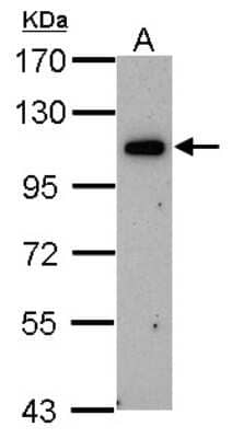 Western Blot: OSBPL6 Antibody [NBP1-31456]