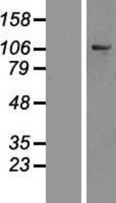 Western Blot: OSBPL6 Overexpression Lysate [NBP2-05465]