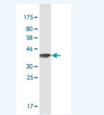 Western Blot: OSBPL7 Antibody (3D11) [H00114881-M03]