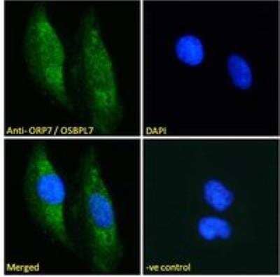 Immunocytochemistry/ Immunofluorescence: OSBPL7 Antibody [NB100-1335]