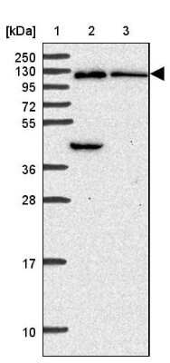 Western Blot: OSBPL7 Antibody [NBP2-38689]