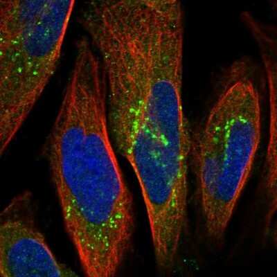 Immunocytochemistry/ Immunofluorescence: OSBPL9 Antibody [NBP1-86390]