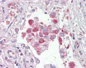 Immunohistochemistry-Paraffin: OSBPL9 Antibody [NB100-1336]