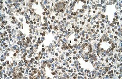 Immunohistochemistry-Paraffin: OSBPL9 Antibody [NBP1-55152]