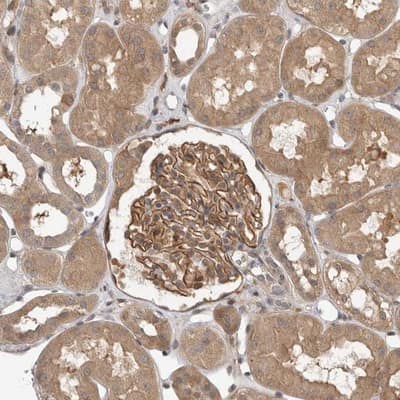 Immunohistochemistry-Paraffin: OSBPL9 Antibody [NBP1-86390]
