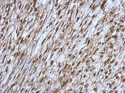 Immunohistochemistry-Paraffin: OSBPL9 Antibody [NBP2-19640]