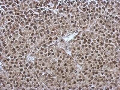Immunohistochemistry-Paraffin: OSBPL9 Antibody [NBP2-19640]