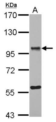 Western Blot: OSBPL9 Antibody [NBP2-19640]