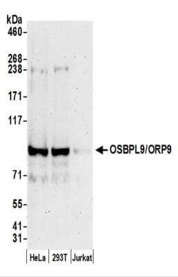 Western Blot: OSBPL9 Antibody [NBP2-44280]