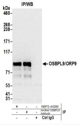 Immunoprecipitation: OSBPL9 Antibody [NBP2-44280]