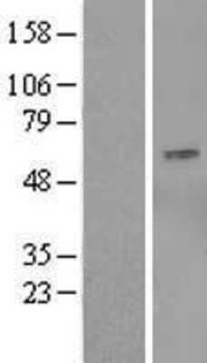 Western Blot: OSBPL9 Overexpression Lysate [NBL1-13995]