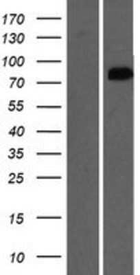 Western Blot: OSBPL9 Overexpression Lysate [NBP2-09994]