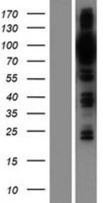 Western Blot: OSBPL9 Overexpression Lysate [NBP2-09995]