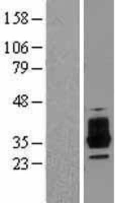 Western Blot: OSCAR Overexpression Lysate [NBL1-13997]