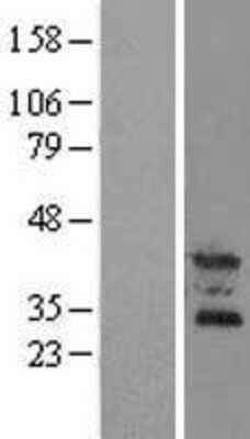 Western Blot: OSCAR Overexpression Lysate [NBL1-13998]