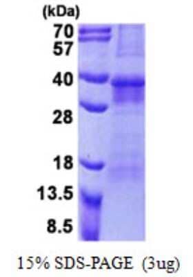 SDS-PAGE: Recombinant Human OSCAR His Protein [NBP2-23312]