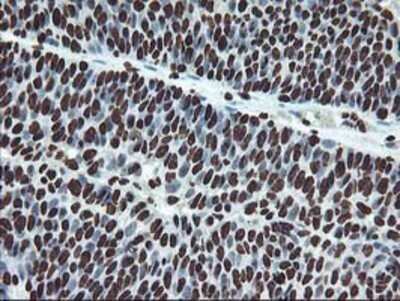 Immunohistochemistry: OSGEP Antibody (OTI9E3) - Azide and BSA Free [NBP2-73163]