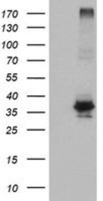 Western Blot: OSGEP Antibody (OTI9E3)Azide and BSA Free [NBP2-73163]