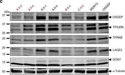 Western Blot: OSGEP Antibody (OTI9E3) [NBP2-00823]