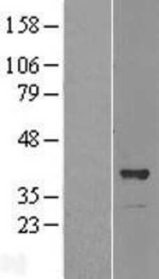 Western Blot: OSGEP Overexpression Lysate [NBL1-13999]