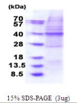 SDS-PAGE: Recombinant Human OSGEP His Protein [NBP2-51805]