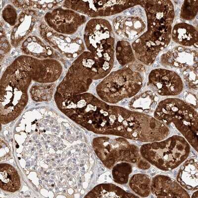 Immunohistochemistry-Paraffin: OSGEPL1 Antibody [NBP1-85928]