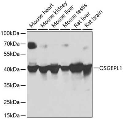 Western Blot: OSGEPL1 AntibodyBSA Free [NBP2-93751]