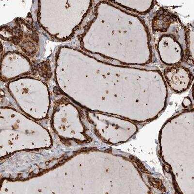 Immunohistochemistry: OSGIN2 Antibody [NBP1-86723]