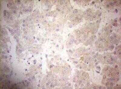 Immunohistochemistry: OSGIN2 Antibody (OTI7D12) - Azide and BSA Free [NBP2-73164]