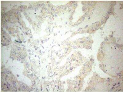 Immunohistochemistry-Paraffin: OSGIN2 Antibody (OTI7D12) [NBP2-46302]