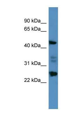 Western Blot: OSGIN2 Antibody [NBP1-68933]