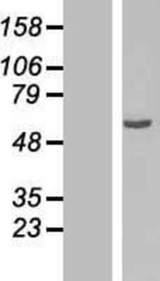 Western Blot: OSGIN2 Overexpression Lysate [NBP2-07878]