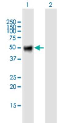 Western Blot: OSMR beta Antibody [H00009180-B01P]