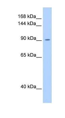 Western Blot: OSMR beta Antibody [NBP1-62543]