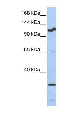 Western Blot: OSMR beta Antibody [NBP1-62544]